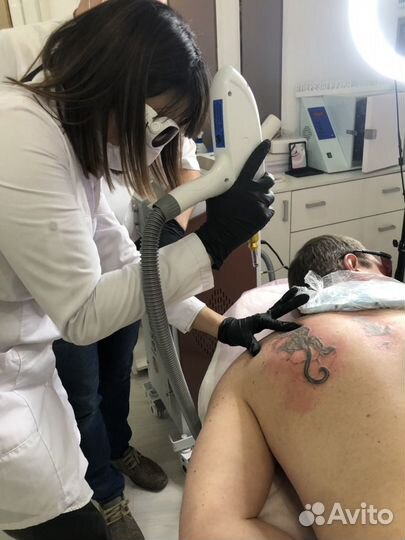 Лазерное удаление татуажа и тату