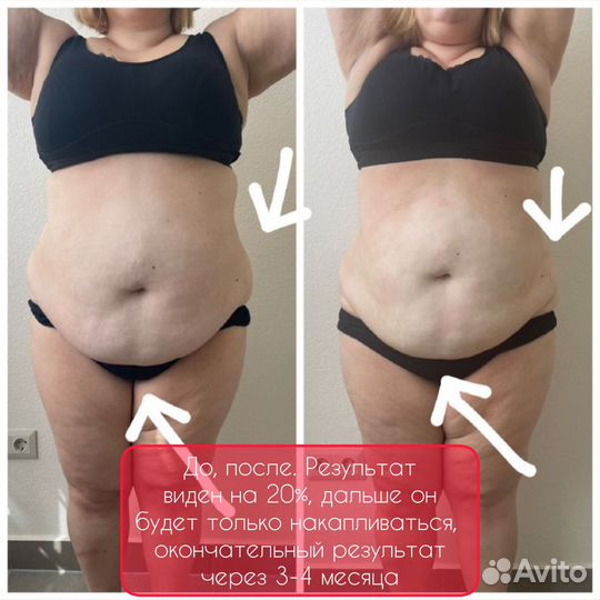 Коррекция фигуры не требующая курса(липосоникс)