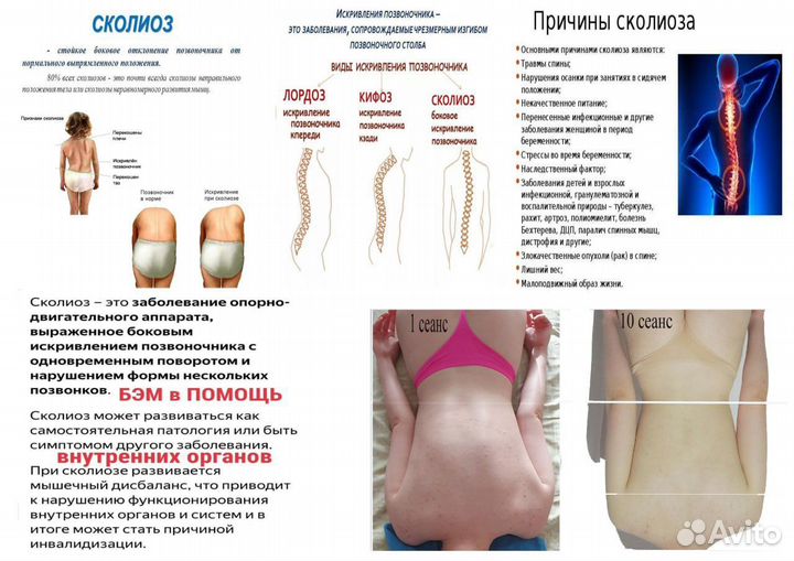 Массаж Биоэнергорегуляции