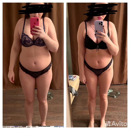 LPG массаж похудение антицеллюлитный массаж