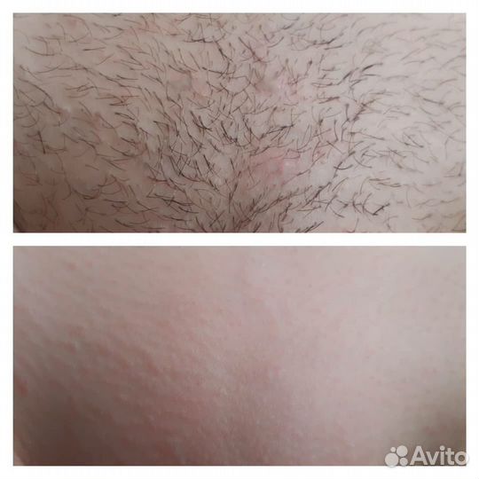 Массаж. Шугаринг