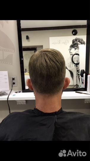 Мужская безоперационная система замещения волос