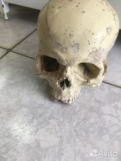 Довоенный медицинский череп