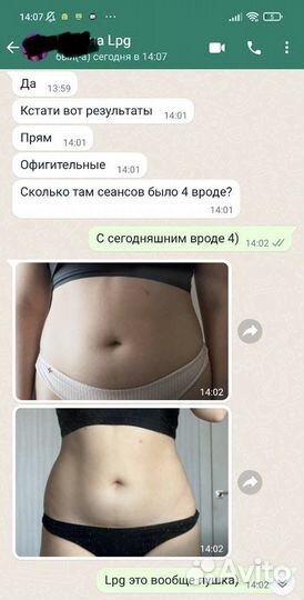 Lpg-массаж, стань лучшей версией себя