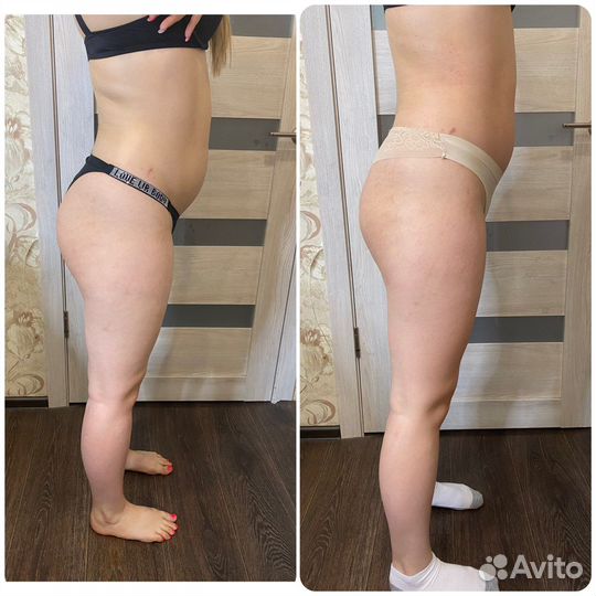 Массаж Аппаратный Ручной медовый