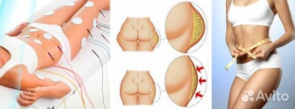 Коррекция фигуры