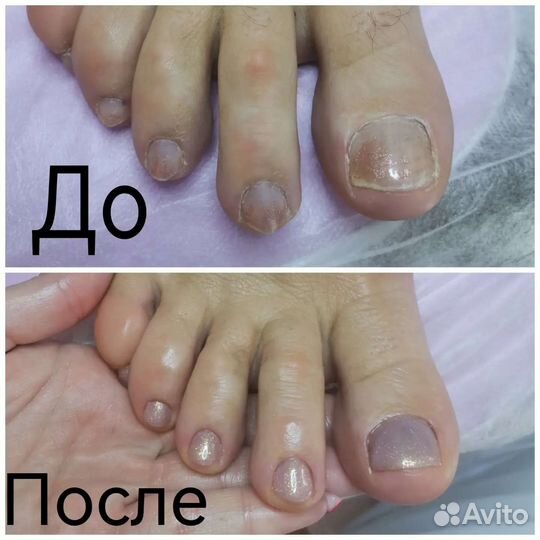 Педикюр, брови