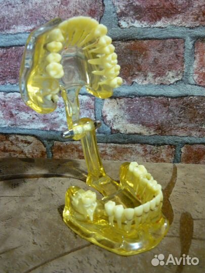 Демонстрационная модель зубов,Патологии