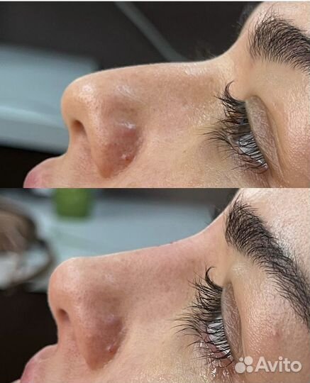 Обучение современной косметологии