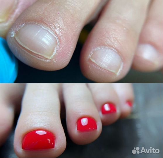 Педикюр гель лак мужской педикюр