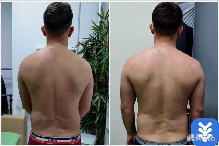 Массаж остеопатический мануальный (костоправ)