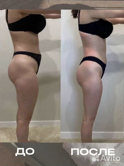 Гидромассаж (подводный вакуумный массаж)