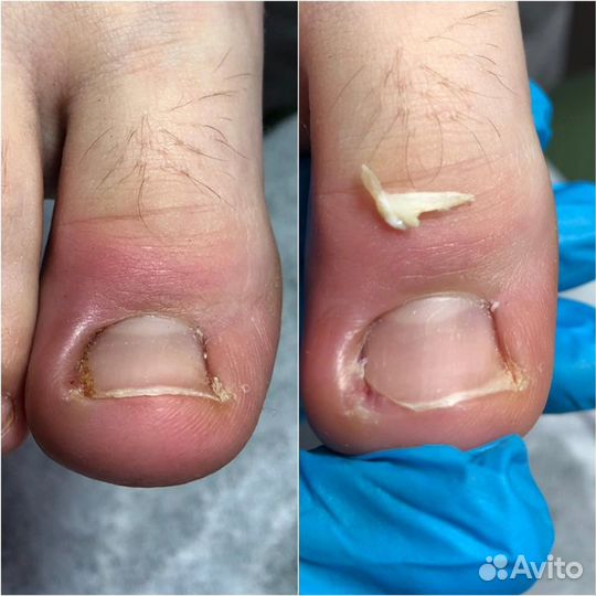 Кабинет педикюра, подолог Лобня