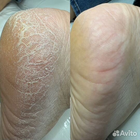 Модели на педикюр