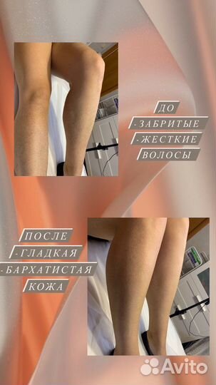 Восковая депиляция
