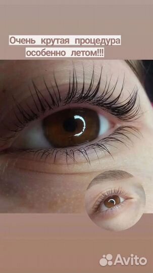 Брови, ресницы