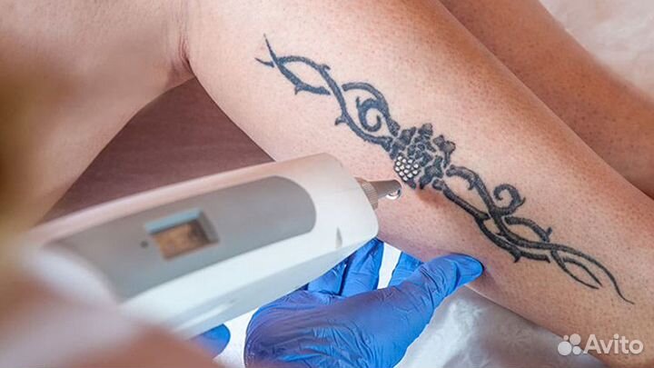Лазер для удаления тату (выставочный образец)