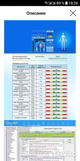 Квантовый биорезонансный анализатор здоровья