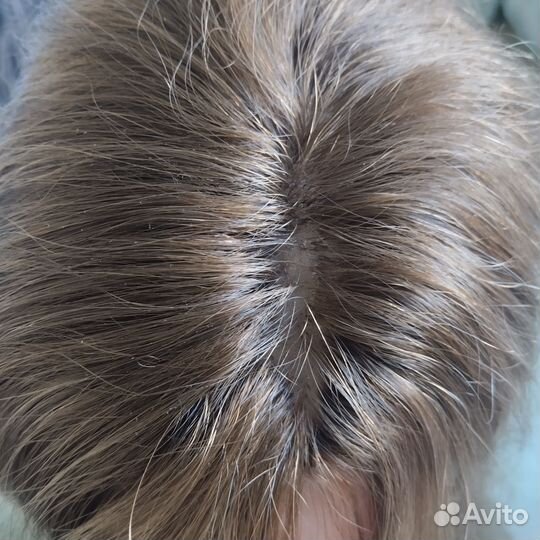 Парик система из натуральных волос,имитация кожи