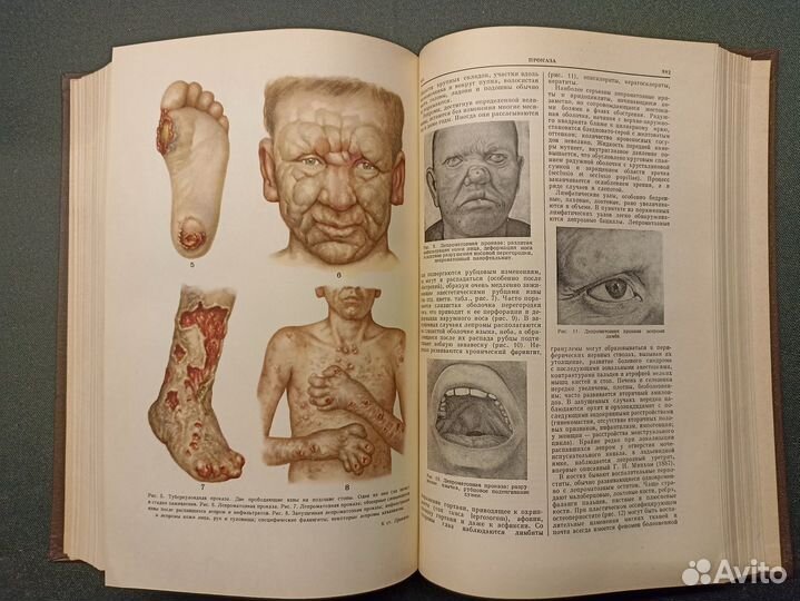 Большая медицинская энциклопедия. Том 26. 1962 