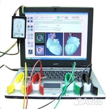 Система скрининга сердца Кардиовизор-6С