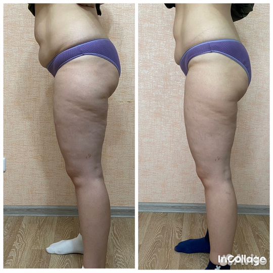 Услуги косметолога массажи инъекции чистка лица