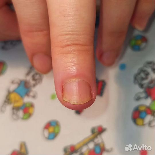 Услуги подолога
