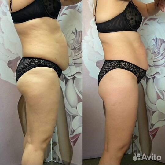 Корректирующий массаж