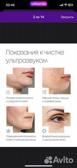 Ультразвуковой аппарат для чистки лица