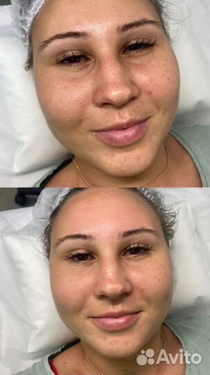 Косметолог эстетист «Крокус»