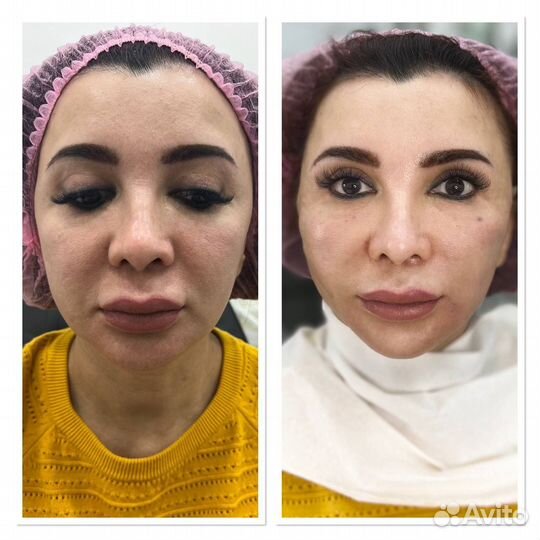 Модель на нити