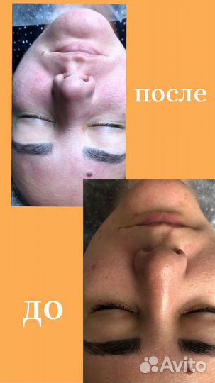 Услуги косметолога