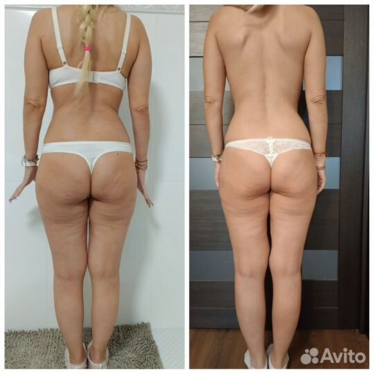 Массаж спины, антицеллюлитный, лимфодренажный