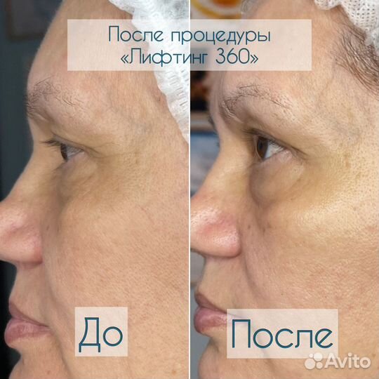 Массаж лица и косметология