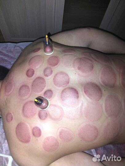 Лечебный массаж на дому