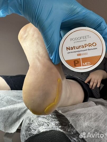 Педикюр медицинский подолог