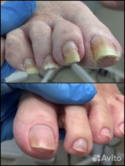 Услуги подолога