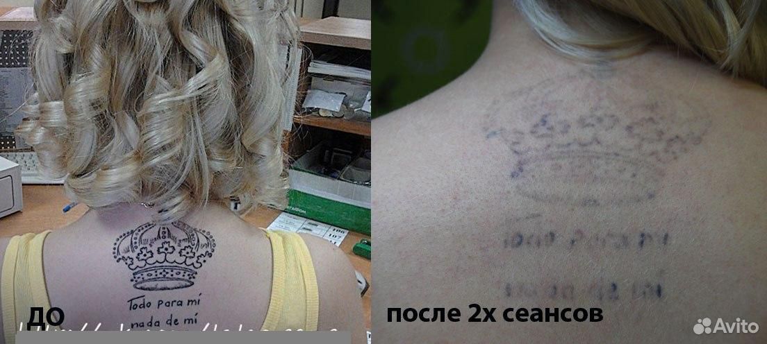 Ptz tattoo Katrin, тату-салон, Ключевая ул., 4, Петрозаводск — Яндекс Карты