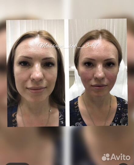 Массаж Лица/Тела.Липолитики.Обертывание