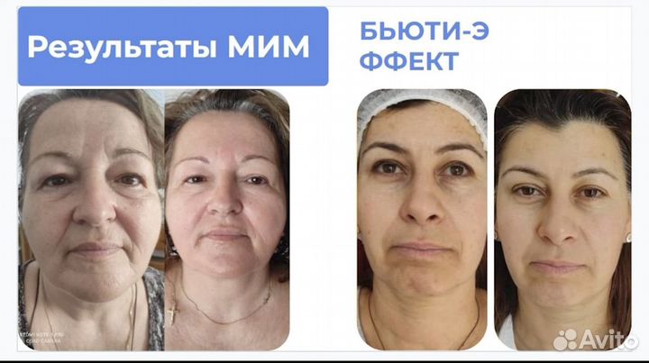 Массаж лица и тела. Уходовые процедуры