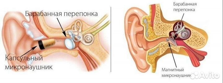 Микрокамера аренда