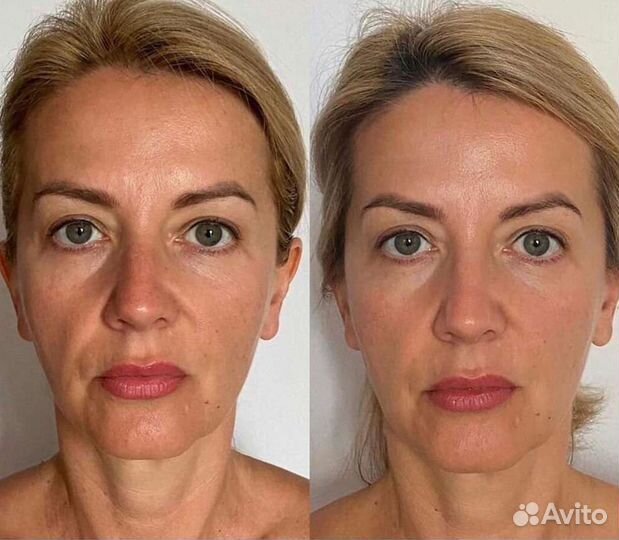 Депиляция,буккальный массаж лиц,чистка лица,брови