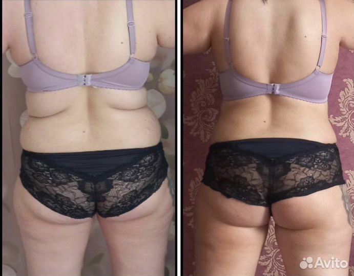 Антицеллюлитный массаж ручной