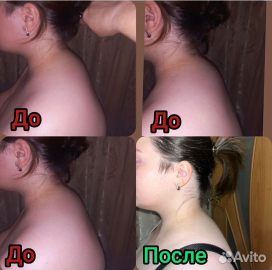Медицинский массаж
