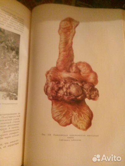 Хирургия брюшной полости.Мельников 1960г