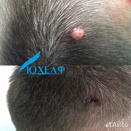 Удаление лазером родинок, папиллом, бородавок