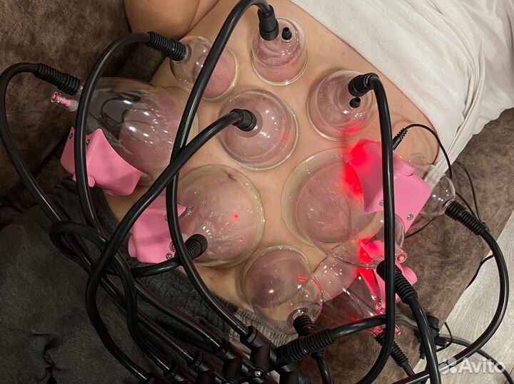 Аппаратный массаж баночный