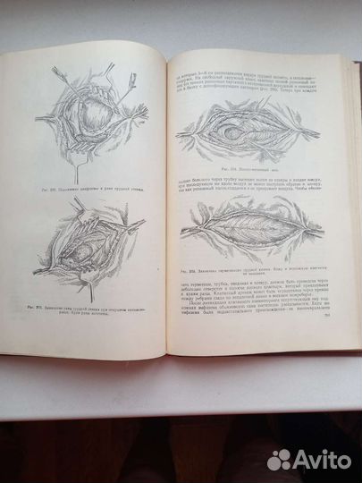 Оперативная хирургия и топографическая анатомия