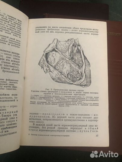 Болезни сердечно-сосудистой системы. Комплект книг