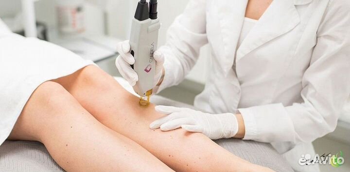 Готовый бизнес: салон лазерной эпиляции
